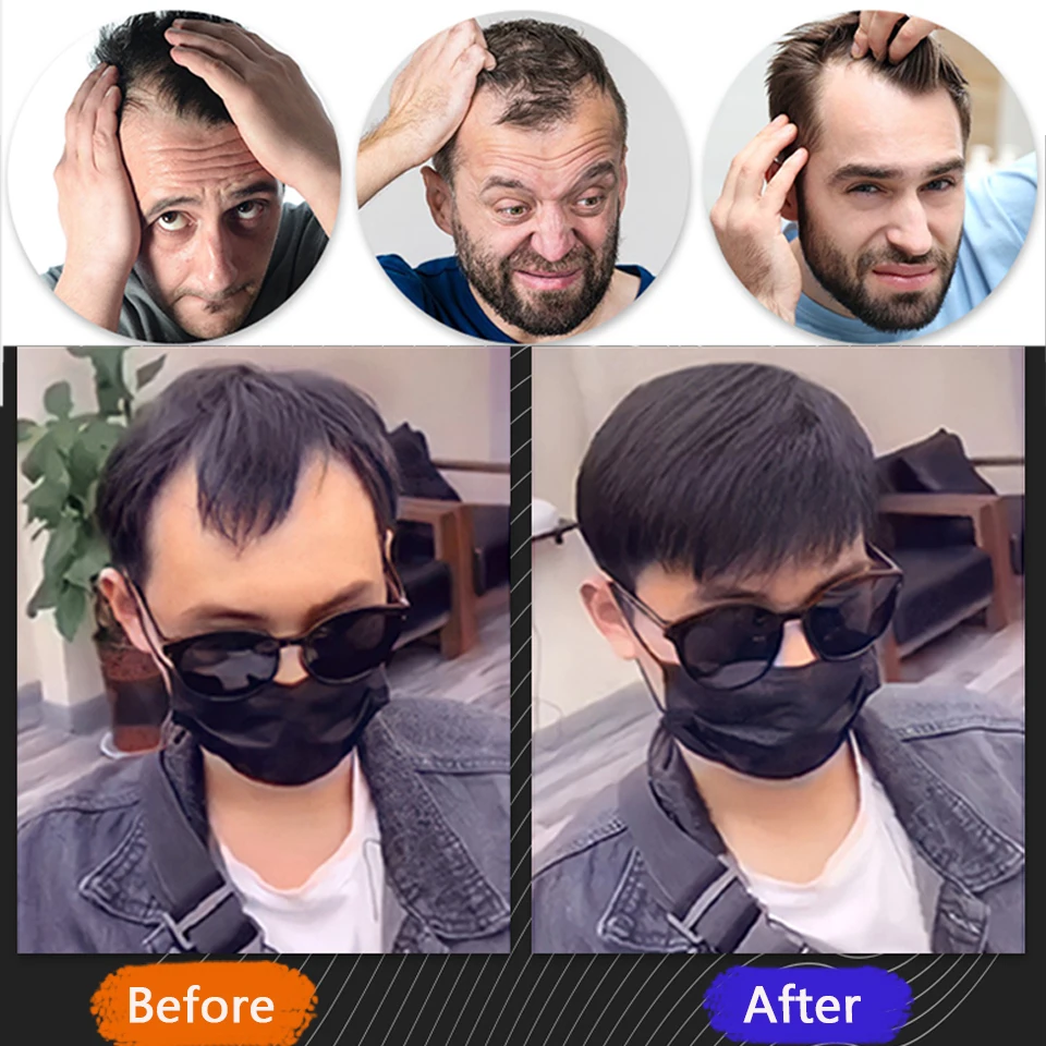 Pageup Synthetic Forehead Hairline Toupees Men's Short Straight V Style Hair Piece Hair Extension Natural Hair Fashion Style Ha
