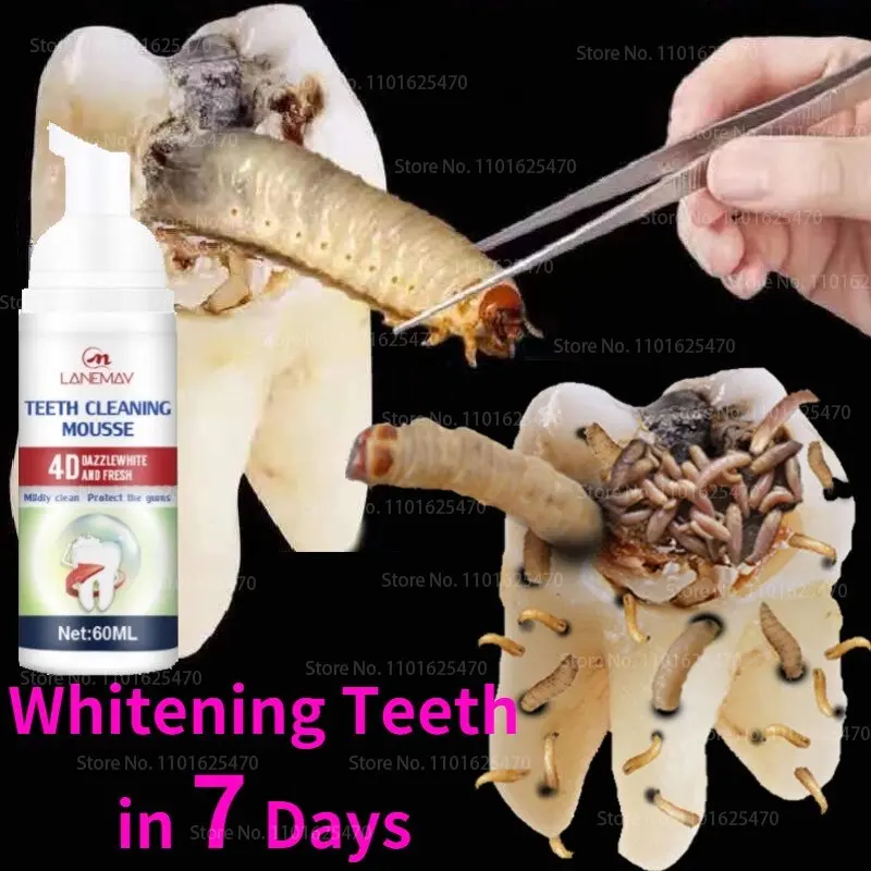 

Tartar Remover Teeth Whitening Mousse 60ml Repair Teeth Prevent Tooth Decay Toothpaste Dental Oral Hygiene Remove