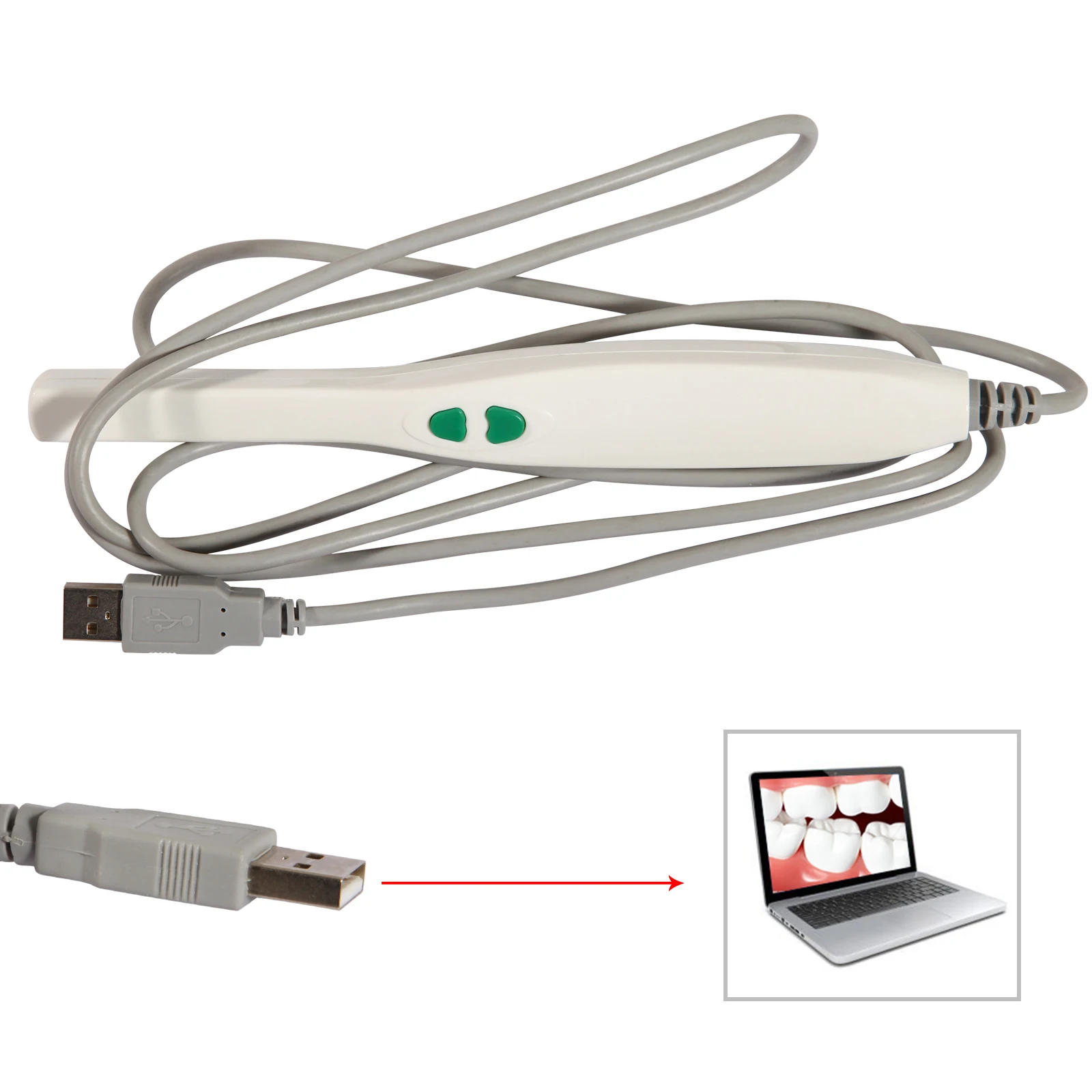 Стоматологическая цифровая Интраоральная внутриоральная камера USB 2 0
