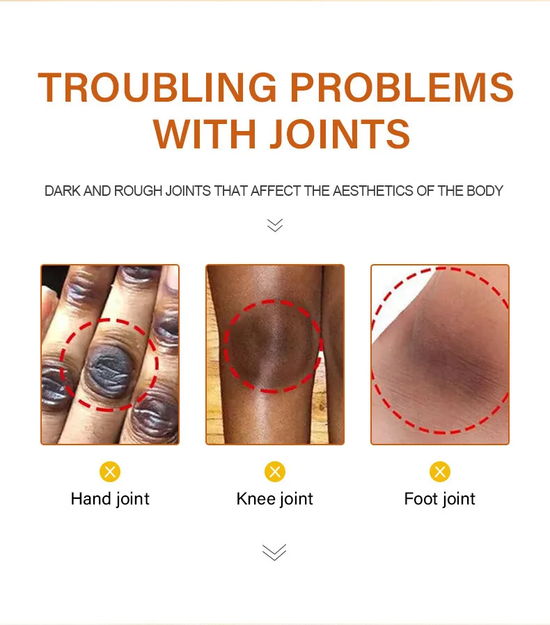 Отбеливающий крем для кожи от Тёмных точек на коже и ногах