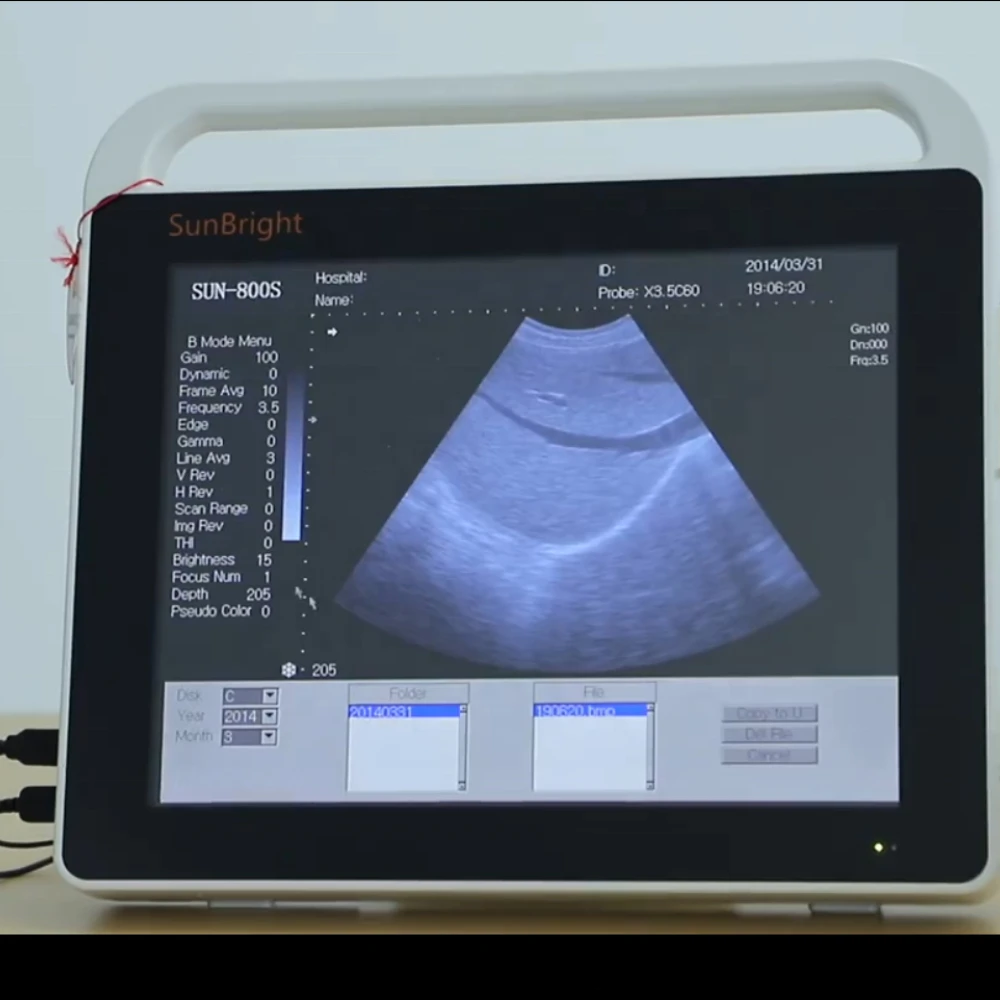 

ultrasound imaging ecografo portatil touch screen ecograph best sonoscape selling ultrasound machine
