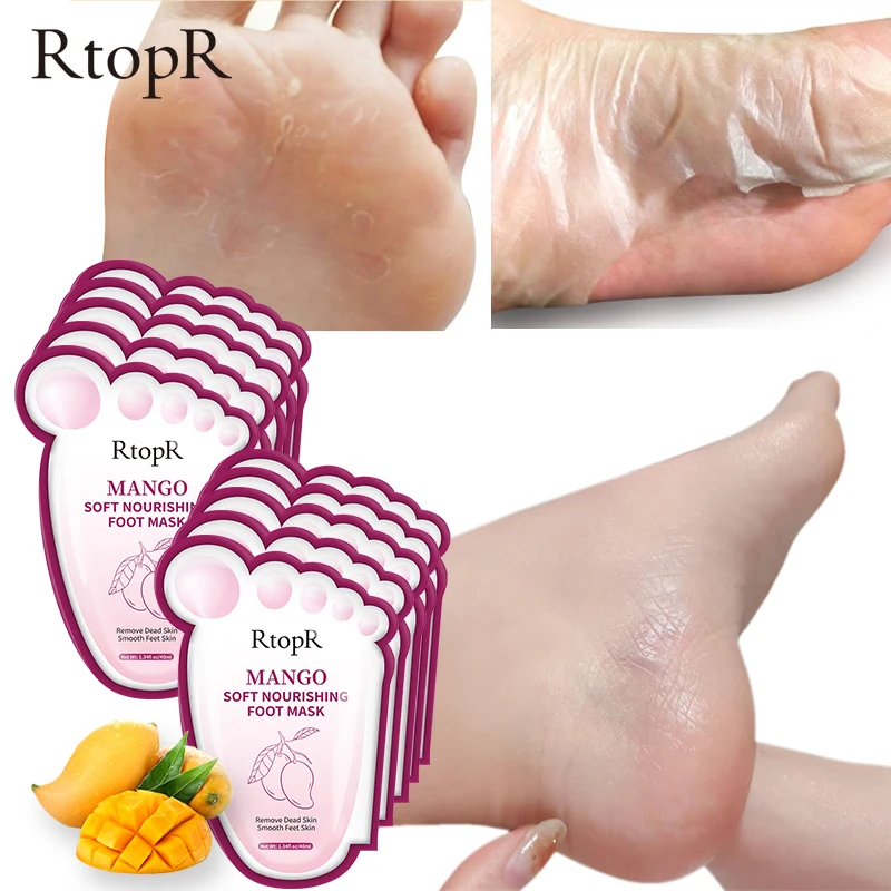 Mango Foot Mask Peel Dead Whitening Moisturizing Exfoliating Renewal Pedicure Remove Dead Skin Heel Socks Peeling Foot Care
