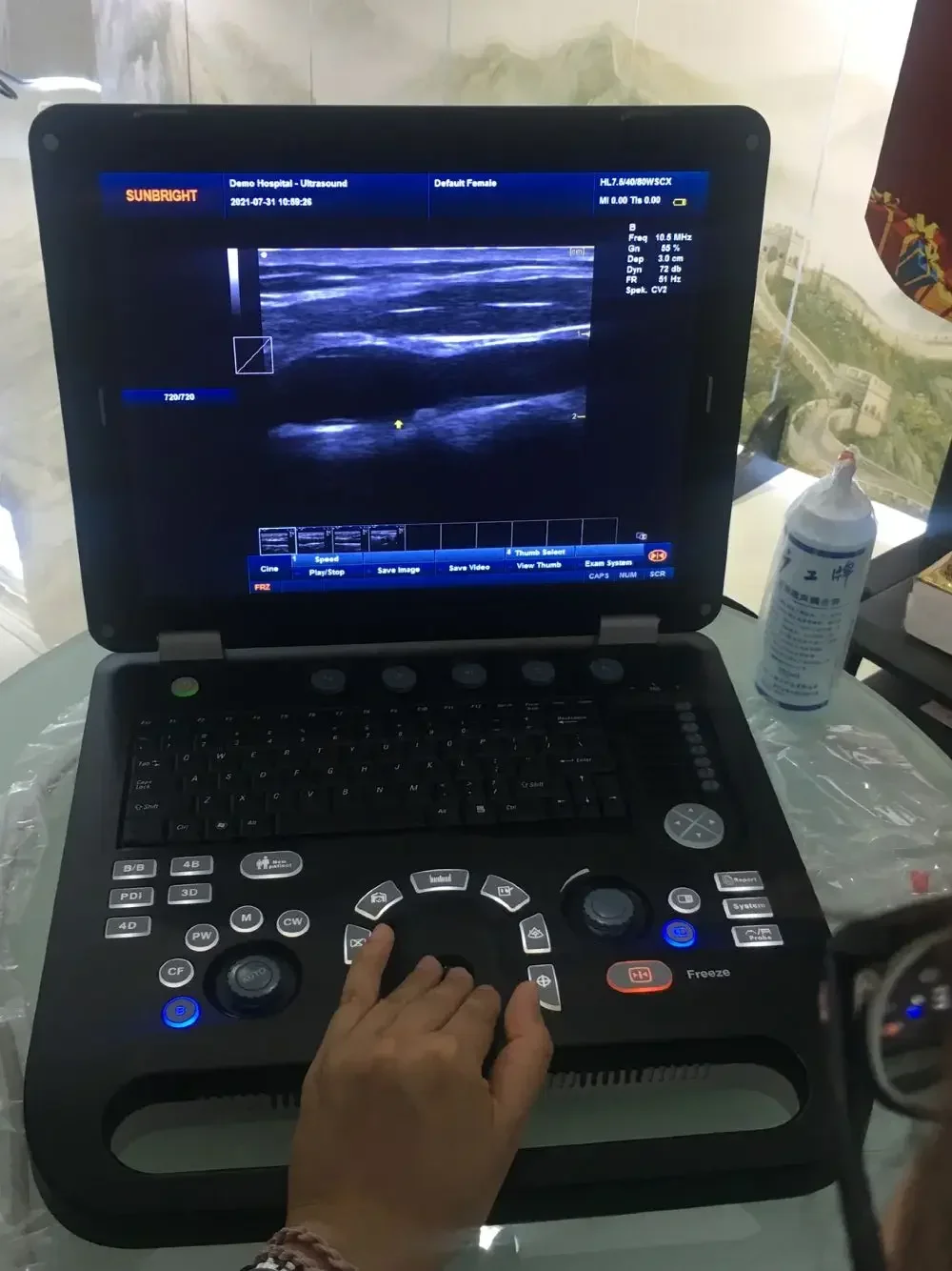 Заводская цена человека портативный 3d цветной доплеровский ультразвуковой