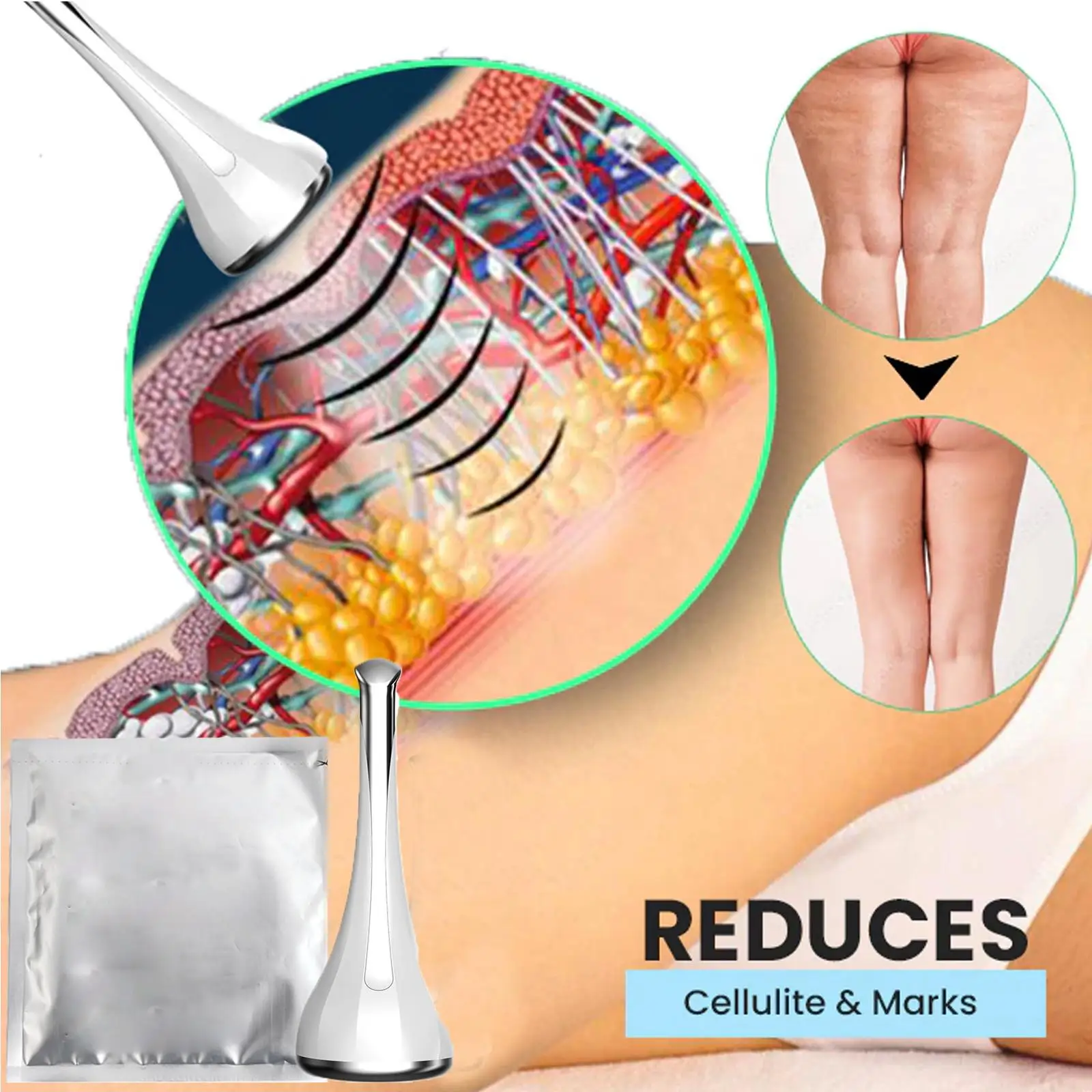 Антифриз 70 г мембрана для замораживания жира аппарат похудения Липо