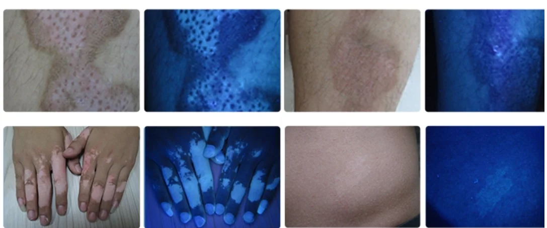 Профессиональная деревянная лампа медицинская лупа фотоанализатор кожи