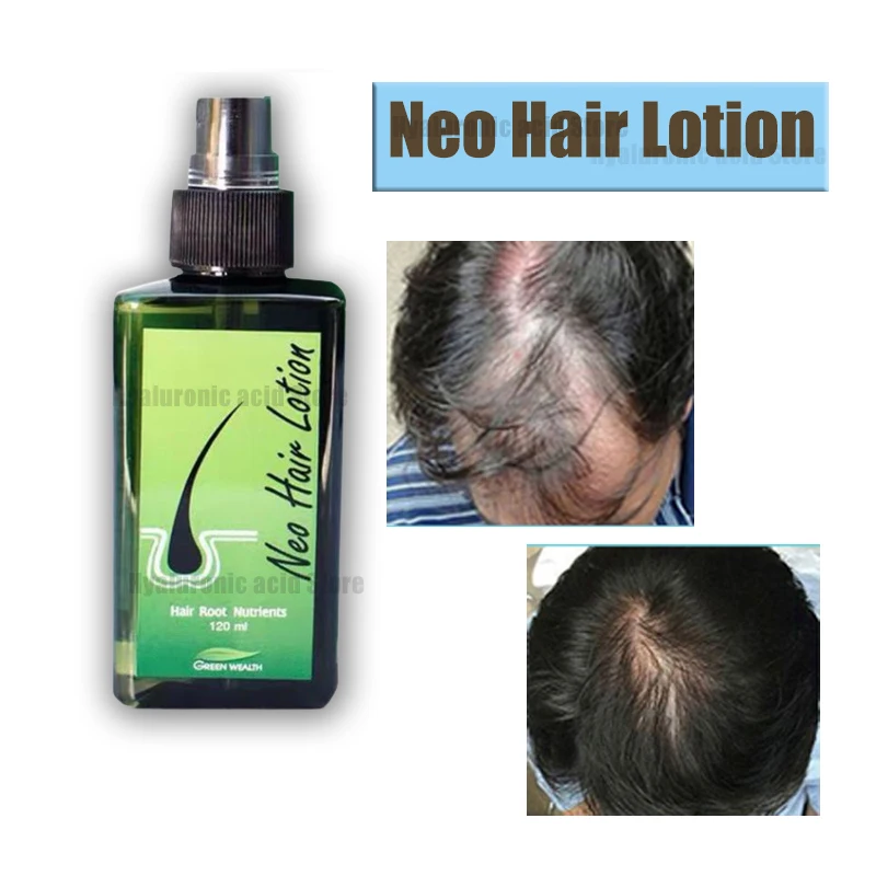 

Neo Hair Lotion Original for Men Women 120ml Hair Growth Treatment Serum Essence Oil Hair Care Hair Loss Beauty Health