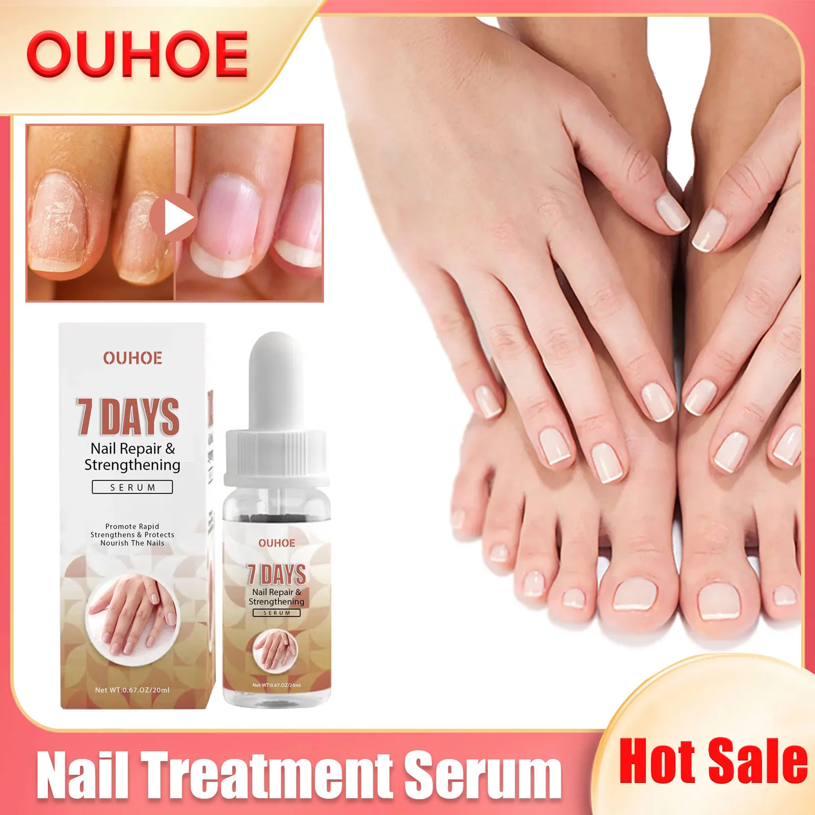 

Nail Treatment Serum Anti Infection Fungal Renew Damaged Onychomycosis Thickening Nourishing Strengthening Nails Repair Essence