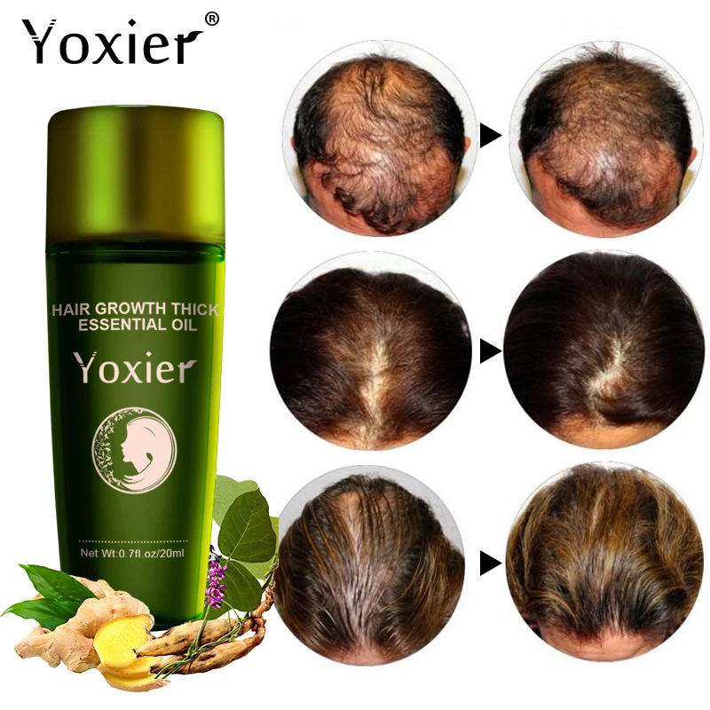 

Yoxier Herbal Hair Growth Essential Oil Shampoo Hair Care Styling Hair Loss Product Thick Fast Repair Growing Treatment Liquid