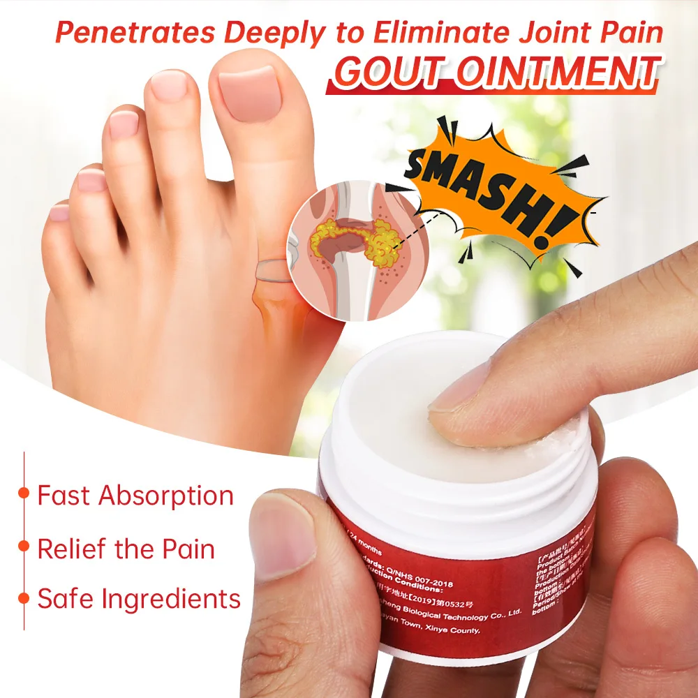 1/3/5 шт. Sumifun мазь для лечения подагры суставов Hallux Valgus обезболивающий крем от