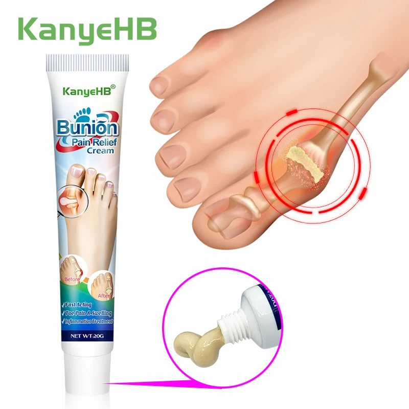 

1pcs Bunion Relief Cream Toe Swell Pain Heel Pain Joint Pain Relief Ointment Hallux Valgus Chinese Herbal Medical Plaster G019