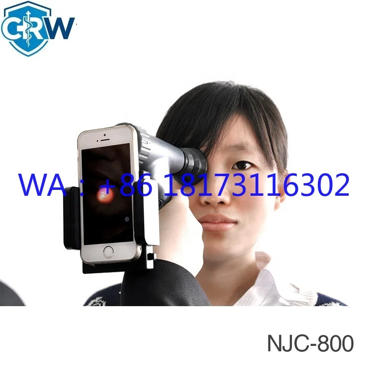 Фото Офтальмоскоп Panoptic CRW NJC-800: Офтальмологическое оборудование для исследования глаз, широкопольный офтальмоскоп для продажи №4