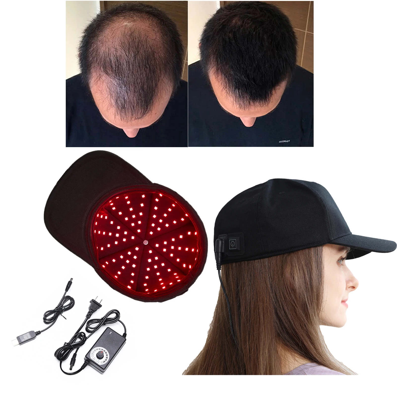 

LED Hair Growth Cap 660nm 850nm 940nm LED Chips Anti Hair Loss,Red Light Therapy Cap Hair Regrowth Treatment Machine