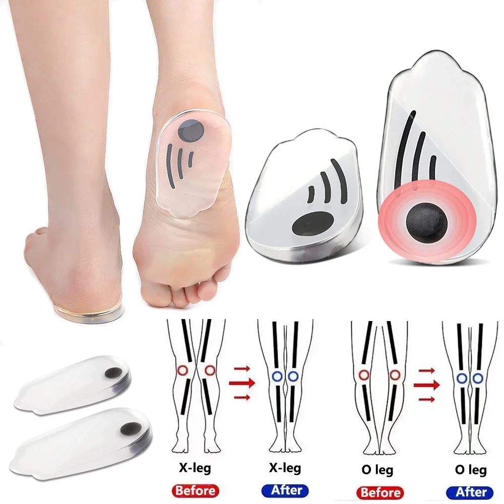 

Silicone Orthopedic Insoles for Shoes Men Women Plantar Fasciitis Relief Foot Care O/X Legs Knee Varus Correction Shoe Heel Pads