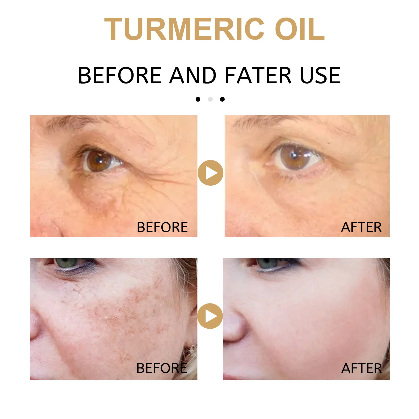 30ml Turmeric Freckle Serum Whitening Dark Spots Organic Oils Brighten Skin Pigment Anti Aging Wrinkle Moisturizer - купить по