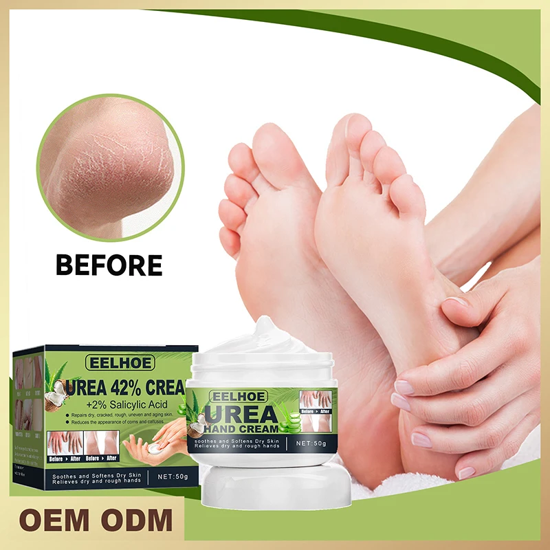 

Травяной крем для удаления трещин ног, восстанавливает омертвевшую кожу, удаляет пятки, треснувшая маска для ног, увлажняет, уход за руками и ногами