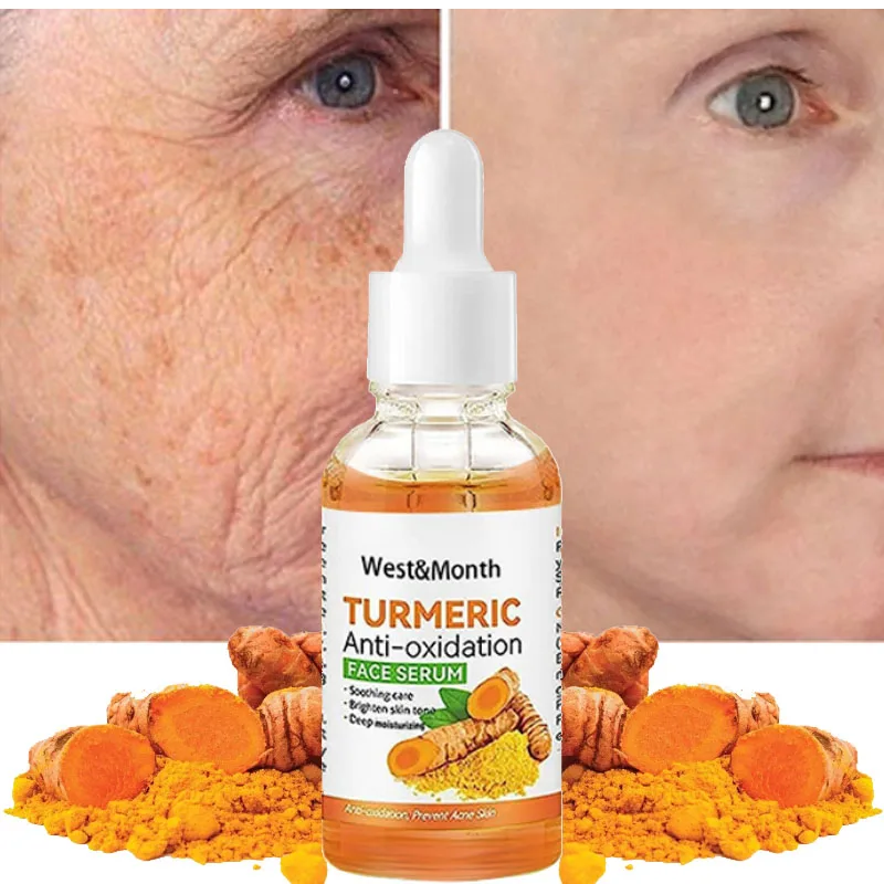 

Turmeric Freckle Whitening Serum Removal Pigment Melanin Fade Dark Spots Facial Essence Brightening Correcting Skin Care 30ml