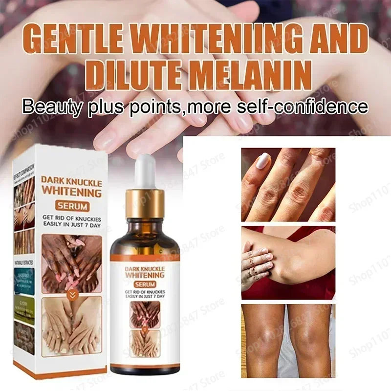 knuckles whitening Essence For Lip Areolas Private Parts Tender Remove Intimate Melanin Skin Care Whitening Dark Spot Body Serum
