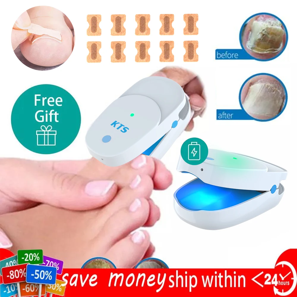 Fungal Nail Treatment Laser Device For Nail Fungus 905nm 470nm Fungus Nail Removal Anti Infection Paronychia Onychomycosis Care