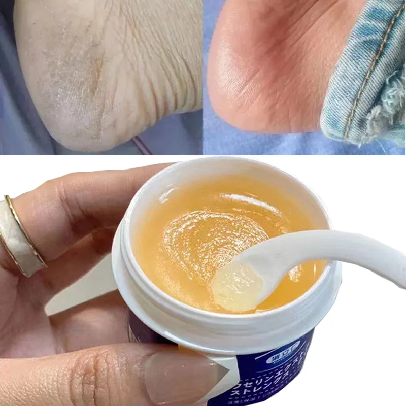 

Japan's Body Skin Foot Care Cream Repair Anti-drying Anti-cracking Moisturizing Exfoliating Heel Mask Removal Callus Whitening