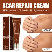 scar cream scar repair acne treatment removal facial body scar smoothing stretch skin body skin care suit scar removal cream