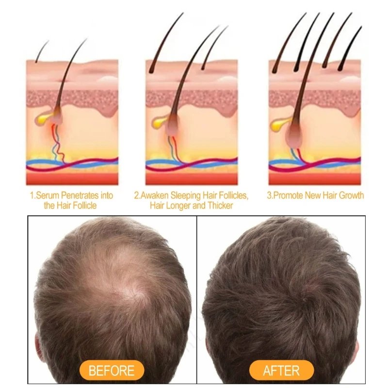 100 мл имбирный шампунь и кондиционер с имбирным шампунем для ухода за волосами