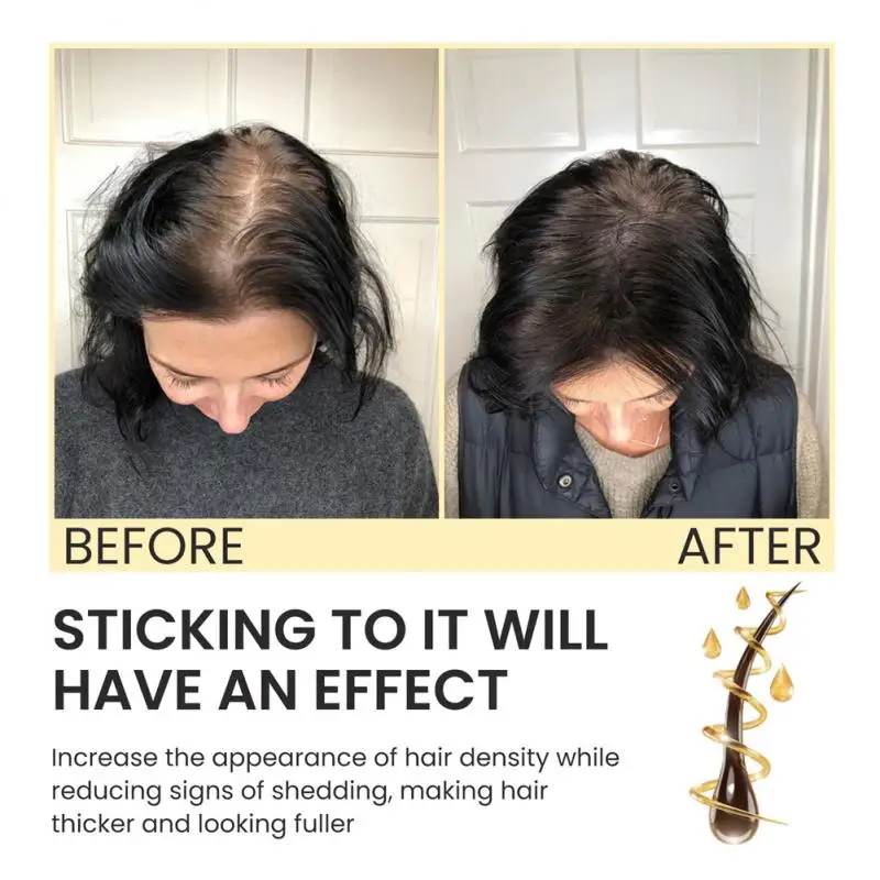 

Hair generating Fast and Powerful Repair Hairline Biotin Dense Hair Prevent Loss Fixation Hair