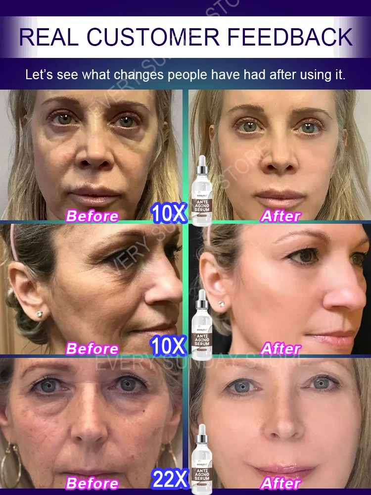 Самый продаваемый продукт всего 7 дней более и молодой красивой 99% покупателей.