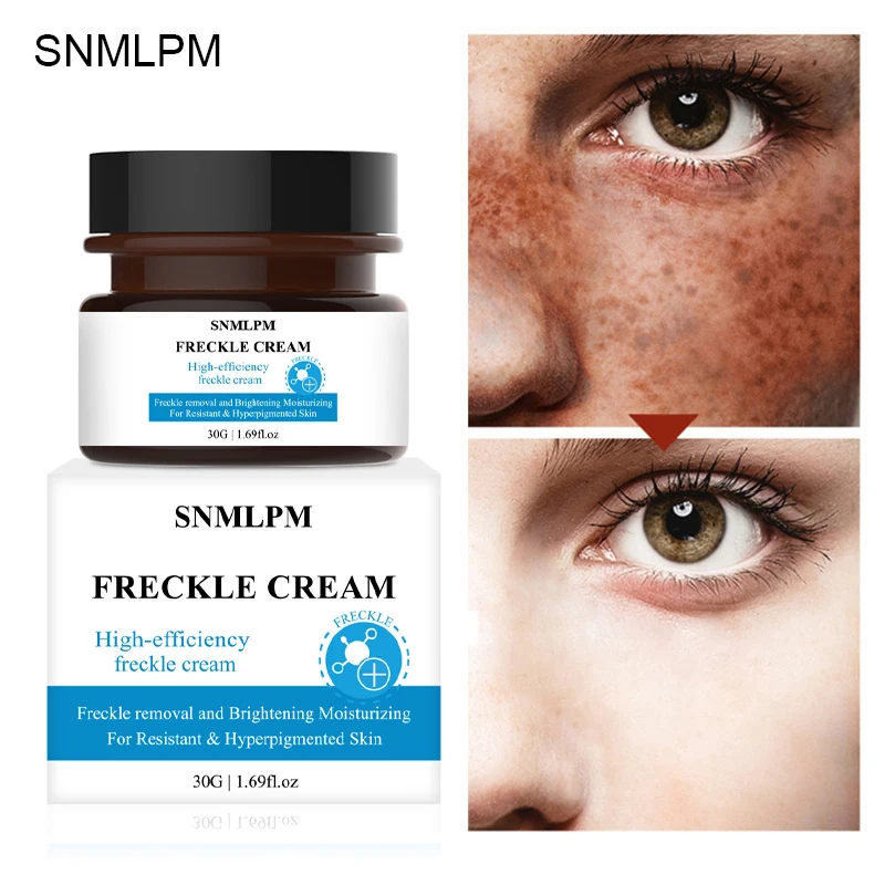 

30/50g Freckle Cream Chinese Remove Freckles Dark And Age Spots Face Cream Moisturizing Whitening Skin Care Cream TSLM1