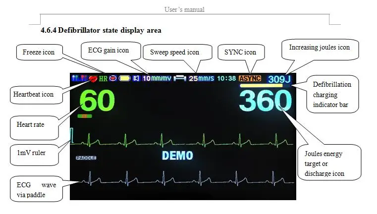 Медицинская больница Emergency AED Автоматическая внешняя бипазовая с функцией (art.: 3920cb862deba) - 3920cb862deba