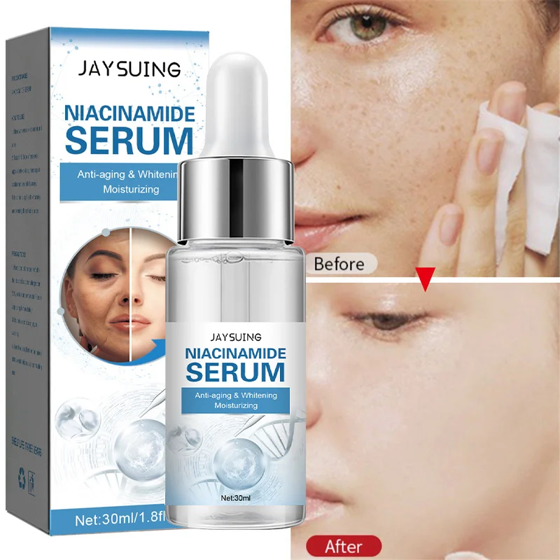 Nicotinamide Whitening Freckles Face Serum Remove Dark Spots Melasma Melanin Anti-Aging Brighten Moisturizing Skin Care Products