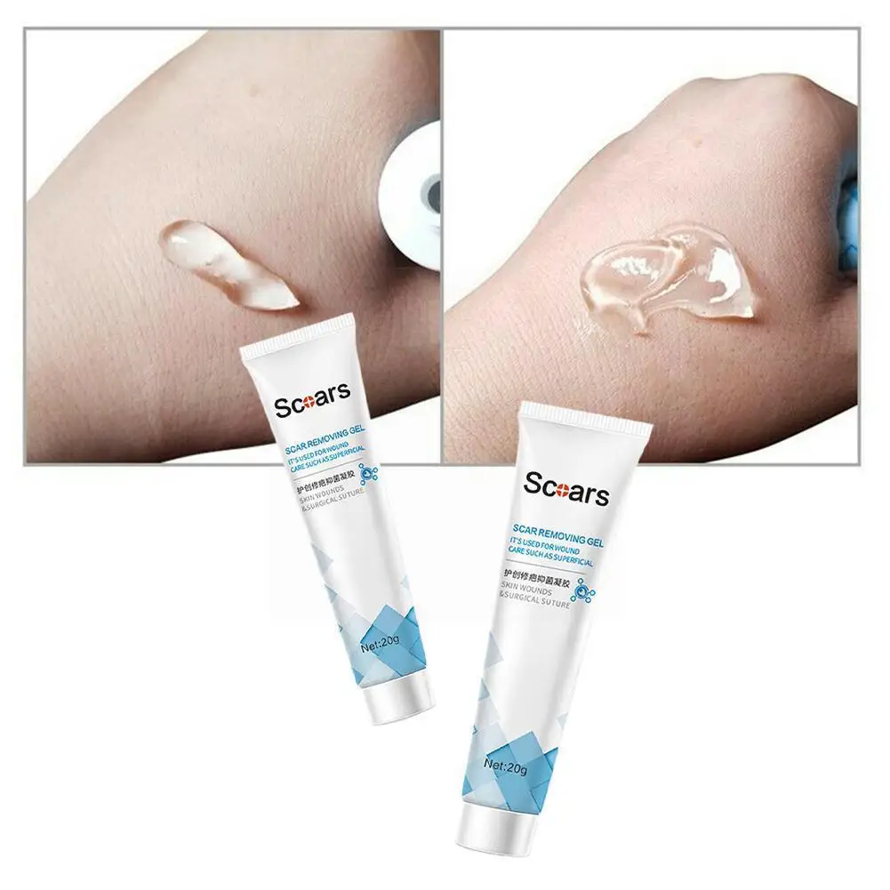 

Scar Cream Lightening Cream Care Wound Repairing Gel Scar Acne Marks Marks Lightening Acne Stretch Pits R8l6