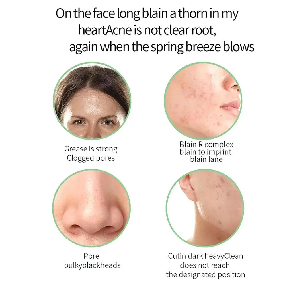 Крем для удаления акне с салициловой кислотой