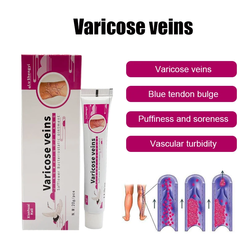 Крем от варикозного расширения вен способствует циркуляции крови и эффективно