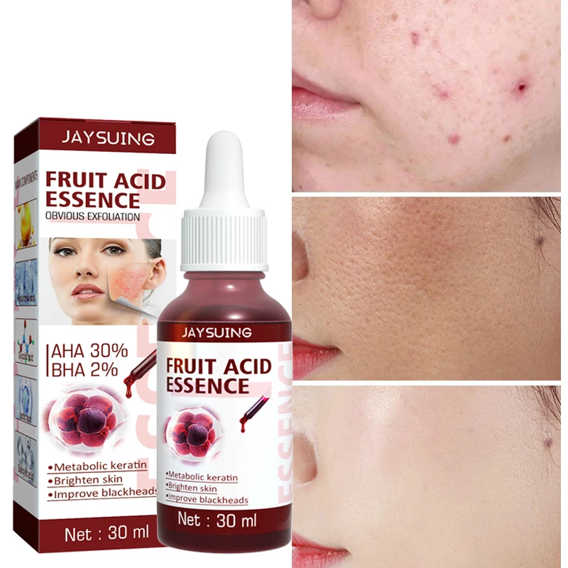 

30ml Salicylic Acid Shrink Pores Face Serum Fruit Exfoliating Anti Acne Moisturizing Essence Smooth Repair Skin Care Products