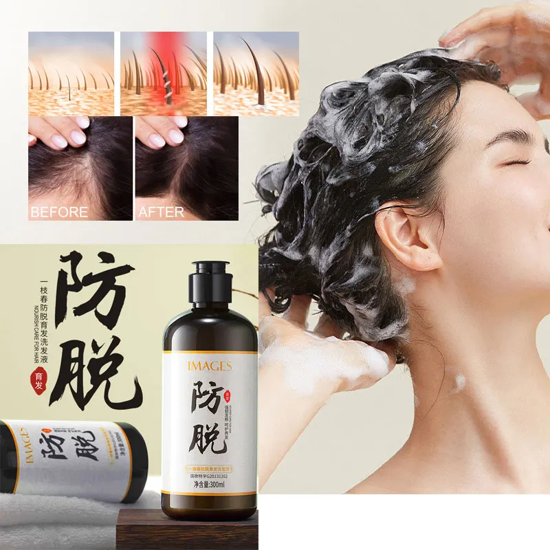 

Sdattor Hair Growth Shampoo Dandruff Hair Care Gingseng Ginger Shampoo Polygonum Multiflorum Tea Seed Saponins Refreshing Oil Co