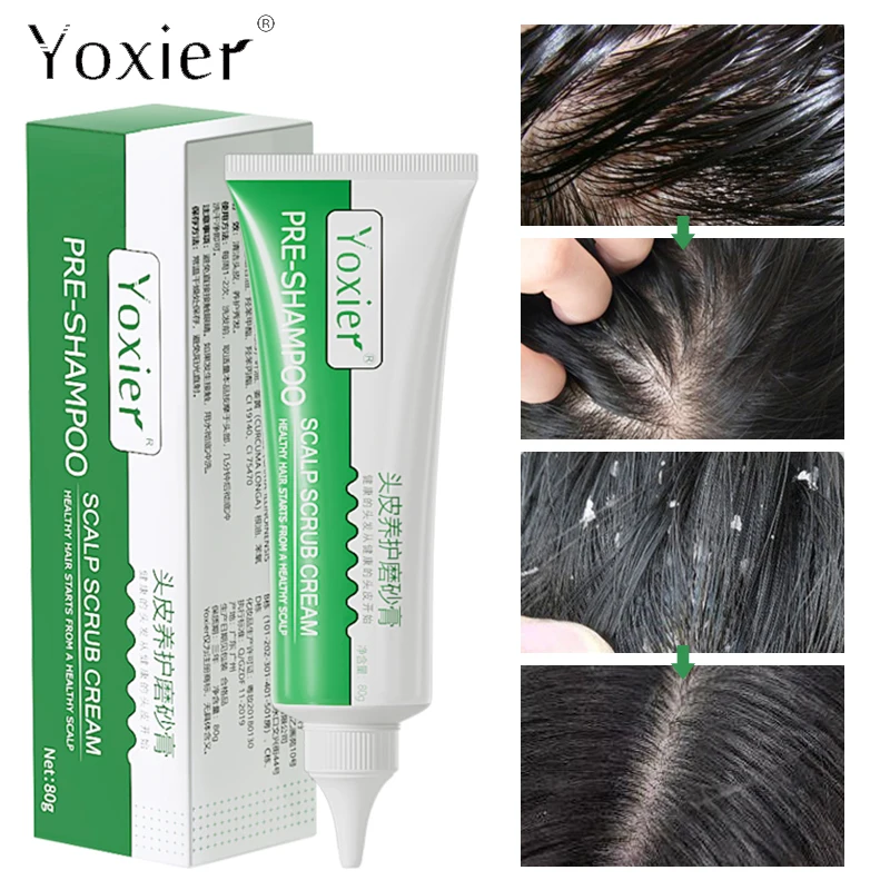 Крем для снятия перхоти и зуда 80 г |