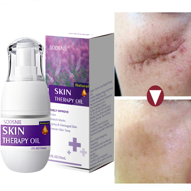 

Herbal Scar Removal Oil Body Stretch Marks Burn Surgical Repairing Scar Firming Improve Cellulite Skin Treatment Whitening Serum