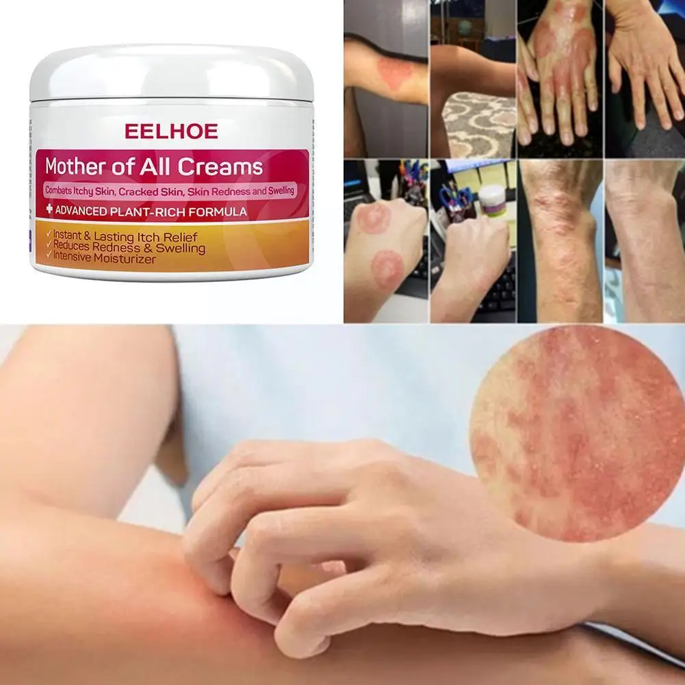 

Skin repair cream Moisturizing Repair Face Cream Deep Remove Anti-Aging Cosmetics Whitening Nourishing Beauty Care Redness Y5O8