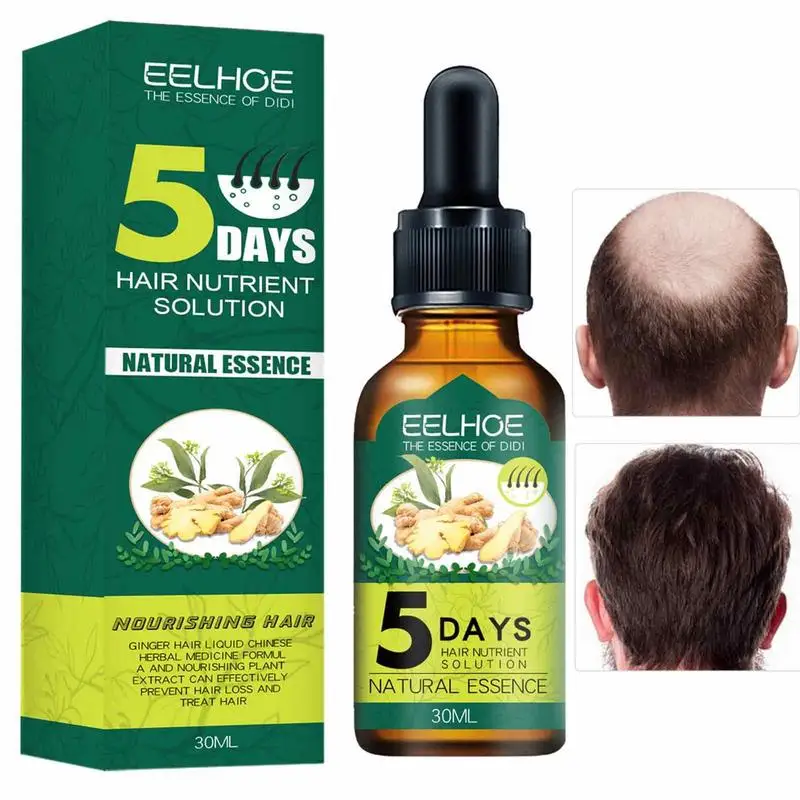 

Ginger Hair Growth Serum Hair Loss Spray 5 Days Effective Germinal Hair Growth Essential Oil Men Women Hair Care 30ml