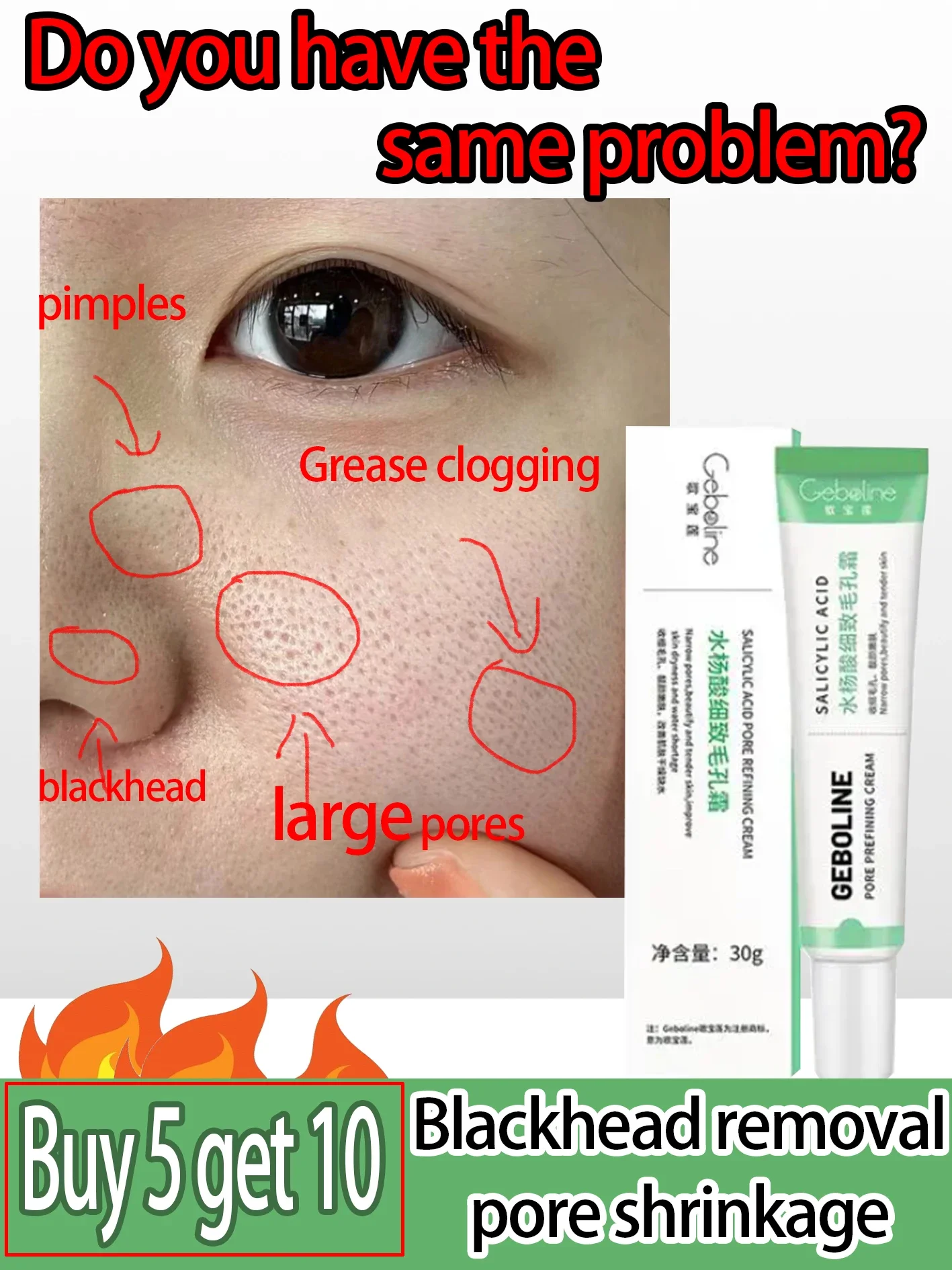 Крем для сужения пор с салициловой кислотой быстрое устранение больших удаление