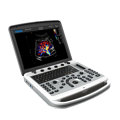 

Chison sonobook 6V clinical diagnosis 4D/5D High Resolution Led Monitor Chison Portable Ultrasound Machine for Vet