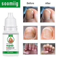 onychomycosis caused by fungal infection natural fungal nail care essential oil enhances nail repair function