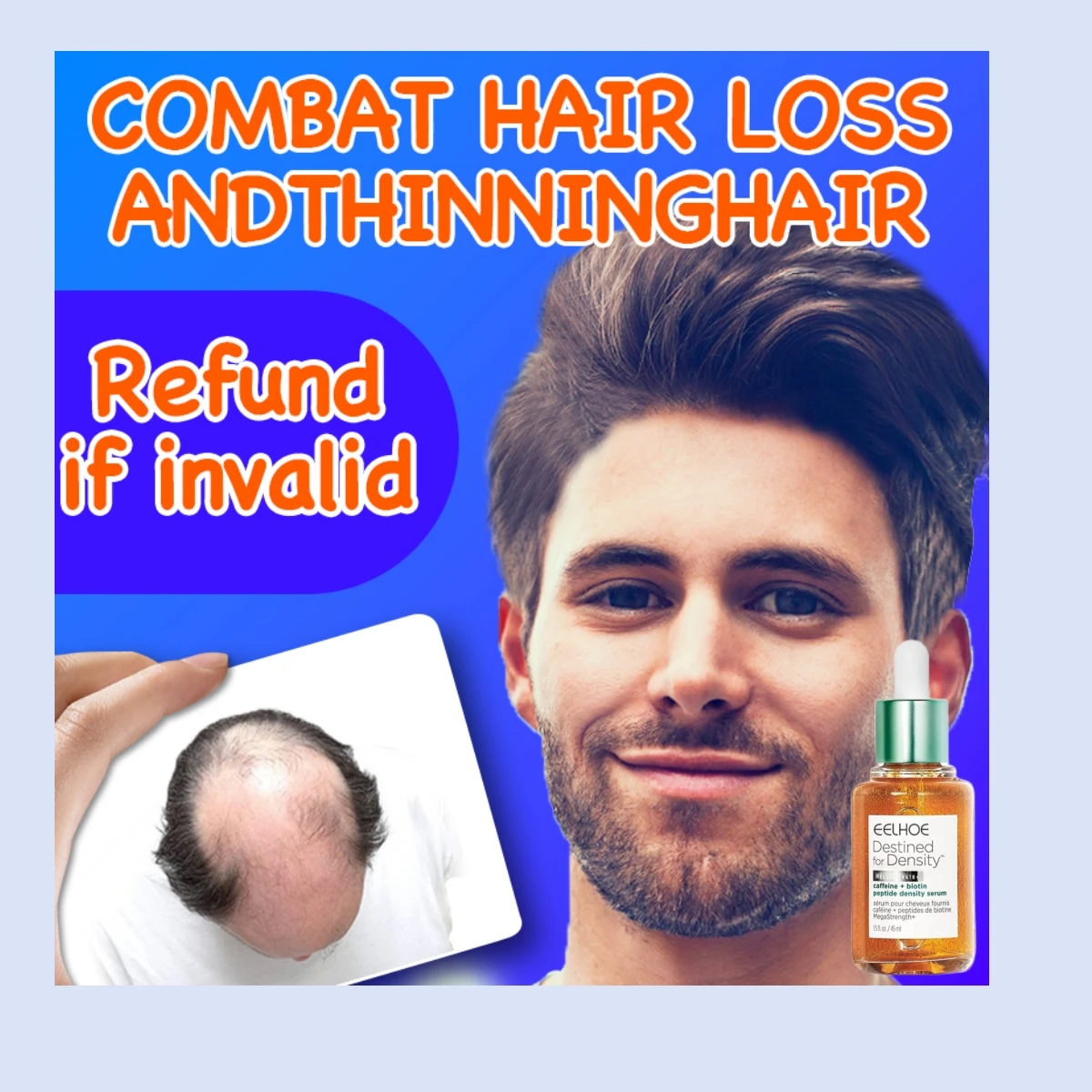 

Fast Hair Growth Essential Oil Hair Regrowth Serum Follicle Treatment Prevent Seborrheic Alopecia Hairline Upward for Women Men