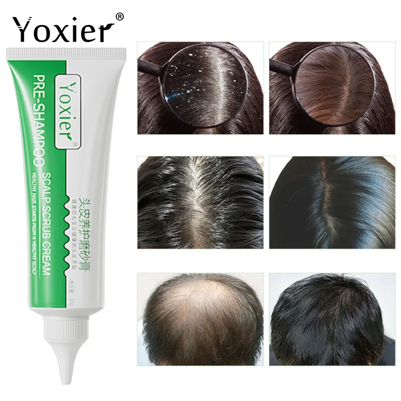 Hair Growth Pre-Shampoo Scalp Scrub Oil Control Antiprurtic Treatmen Alopecia Dandruf Peeling Areata Scalp Mites Care