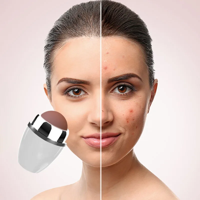 Косметология проблемная кожа. Скрабирование лица. Сухая кожа. Веснушки на лице. Как исправить кожу лица.