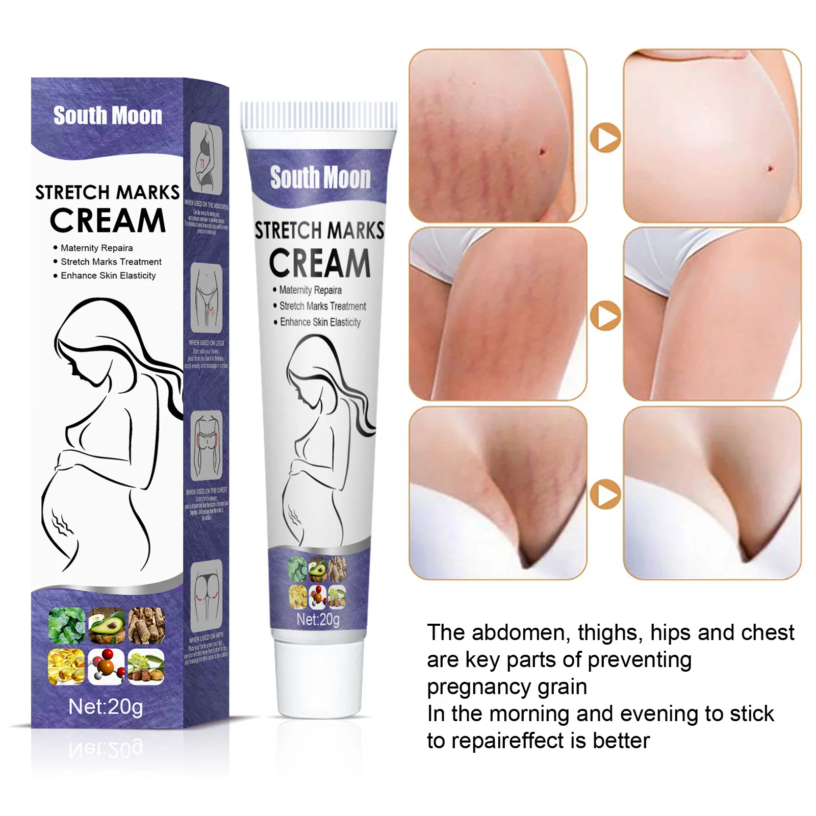 Stretch mark repair cream postpartum stretch mark removal Mommy cream desalination growth lines obese lines stretch mark repair