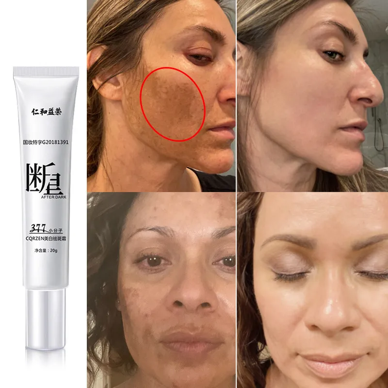 Face Whitening Freckles Cream Remove Melasma Dark Spot Lightening Melanin Moisturizing Brighten Anti-Aging Skin Care Cosmetics
