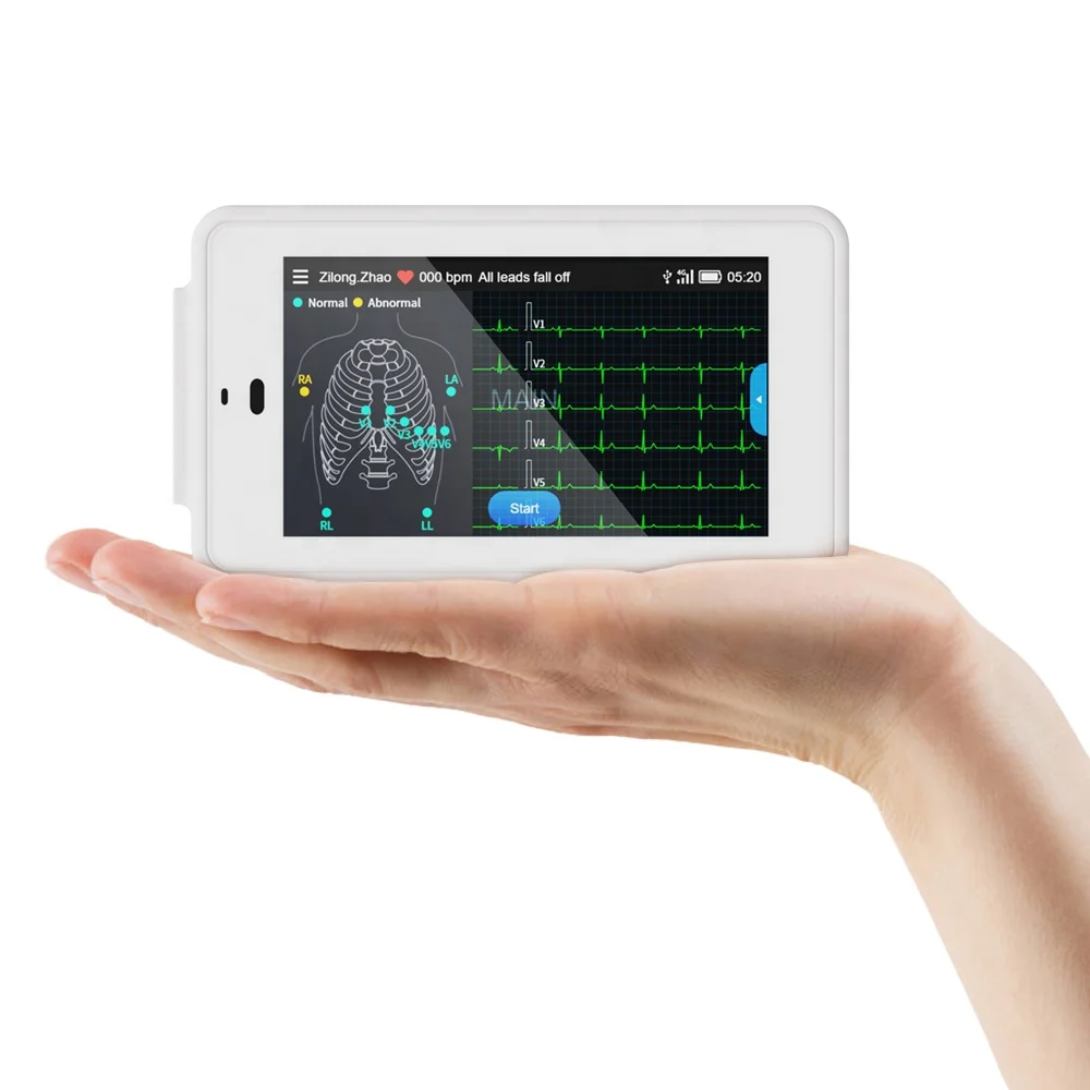 

Wellue PCECG 500 Electrocardiograph Portable Handheld ECG Machine 12 Lead ECG