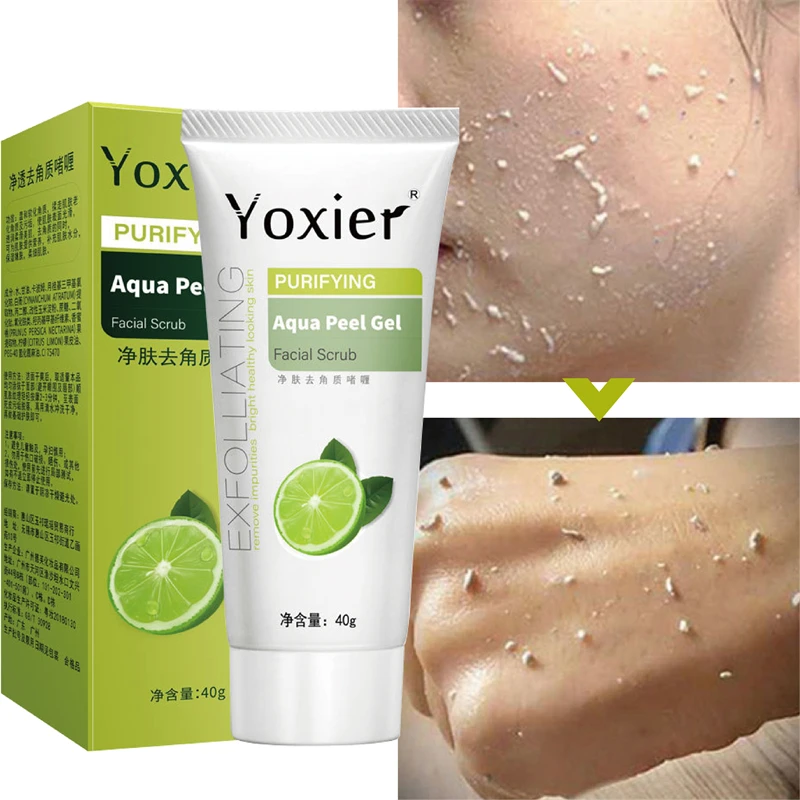 

Exfoliating Face Scrub Exfoliating Dead Skin Deep Cleansing Treatment Acne Gel Lemon Vitamin C Whitening Brightening Skin Care