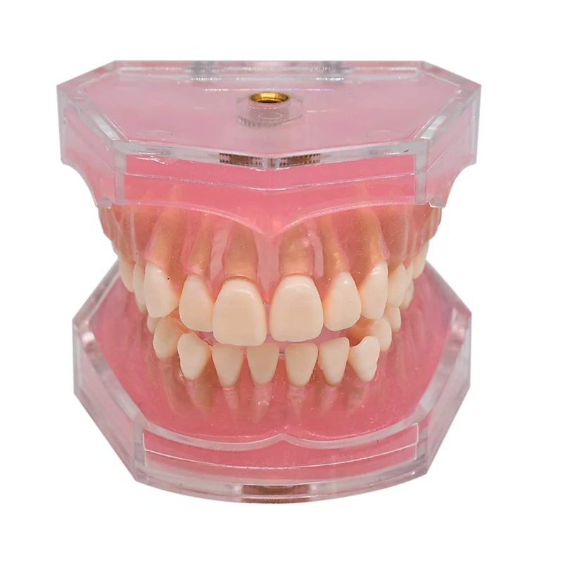 

Standard Model With Removable Teeth 4004 01 Study Teach Teeth Model
